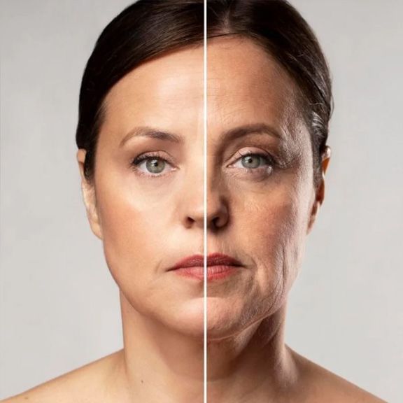 Antes e depois do protocolo Fusion Glow · Dra. Vânia Viana
